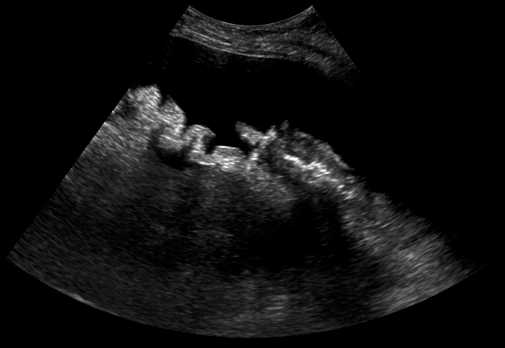 Example ultrasound image
